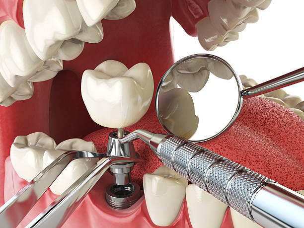 Best Emergency Denture Repair in Cooper, TX