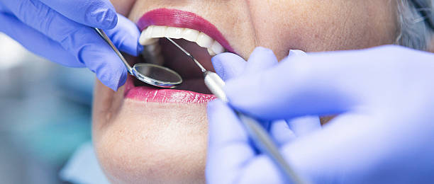 Best Emergency Dental Care for Broken or Chipped Teeth in Cooper, TX